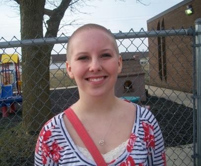 Picture of Emily after hair shaved off